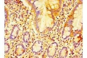 Immunohistochemistry of paraffin-embedded human small intestine tissue using ABIN7152225 at dilution of 1:100 (ECSIT anticorps  (AA 185-431))