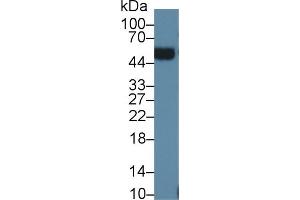 Detection of ORM2 in Human Urine using Polyclonal Antibody to Orosomucoid 2 (ORM2) (Orosomucoid 2 anticorps  (AA 19-207))