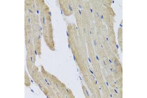 Immunohistochemistry of paraffin-embedded mouse heart using PRPH antibody at dilution of 1:100 (x40 lens). (Peripherin anticorps)