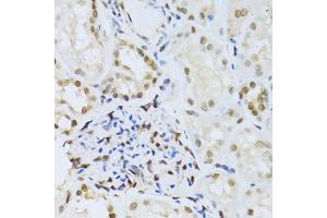 Immunohistochemistry of paraffin-embedded human kidney using MAPK3 Antibody. (ERK1 anticorps)