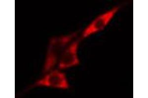 ABIN6267518 staining HeLa cells by IF/ICC. (MTOR anticorps  (pSer2481))