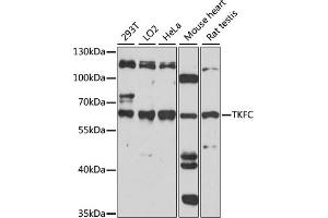 Western blot analysis of extracts of various cell lines, using TKFC antibody (ABIN7266775).