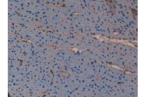 Detection of VCAN in Mouse Heart Tissue using Polyclonal Antibody to Versican (VCAN)
