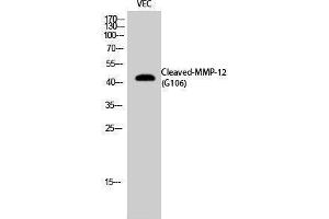 Western Blotting (WB) image for anti-Matrix Metallopeptidase 12 (Macrophage Elastase) (MMP12) (cleaved), (Gly106) antibody (ABIN3181812)