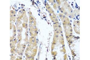 Immunohistochemistry of paraffin-embedded Human stomach using COL9A1 Polyclonal Antibody at dilution of 1:100 (40x lens). (COL9A1 anticorps)