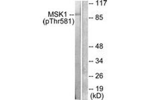Western blot analysis of extracts from RAW264. (MSK1 anticorps  (pThr581))