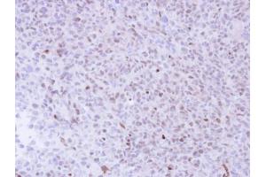 IHC-P Image Immunohistochemical analysis of paraffin-embedded H1299 Xenograft , using NGFRAP1, antibody at 1:100 dilution.