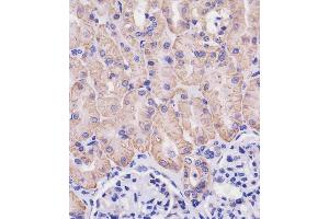 (ABIN654111 and ABIN2843993) staining SLC3A2 in human kidney tissue sections by Immunohistochemistry (IHC-P - paraformaldehyde-fixed, paraffin-embedded sections).
