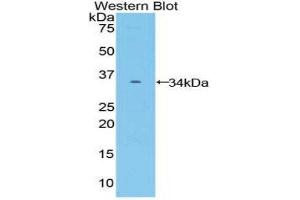 Western Blotting (WB) image for anti-Frizzled Family Receptor 10 (FZD10) (AA 235-495) antibody (ABIN2118061) (FZD10 anticorps  (AA 235-495))