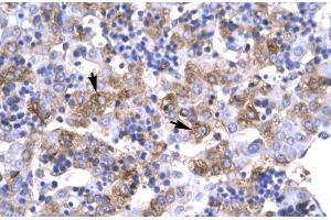 Human Liver; Rabbit Anti-POU1F1 Antibody. (POU1F1 anticorps  (C-Term))