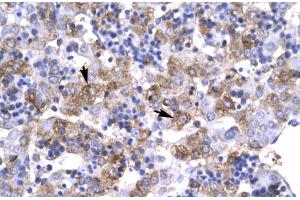 Human Liver; Rabbit Anti-POU1F1 Antibody.