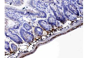 IHC analysis of Periostin using anti-Periostin antibody .