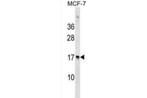 Western Blotting (WB) image for anti-Nudix (Nucleoside Diphosphate Linked Moiety X)-Type Motif 4 (NUDT4) antibody (ABIN2999259)