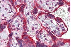 Placenta, Human: Formalin-Fixed, Paraffin-Embedded (FFPE)