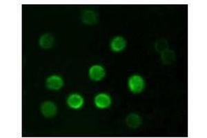 Immunofluorescence analysis of B lymphocytes using CD20 antibody. (CD20 anticorps)