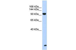 WB Suggested Anti-TNRC6B Antibody Titration:  0. (TNRC6B anticorps  (N-Term))