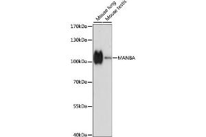 Western blot analysis of extracts of various cell lines, using MANBA antibody (ABIN7268392) at 1:1000 dilution.