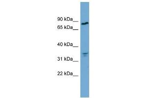 APEH antibody used at 1 ug/ml to detect target protein. (APEH anticorps  (Middle Region))