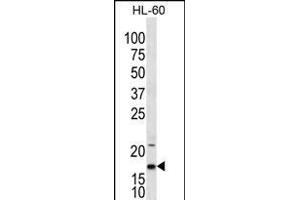 IL1F5 Antibody (N-term) (ABIN656238 and ABIN2845554) western blot analysis in HL-60 cell line lysates (35 μg/lane). (FIL1d anticorps  (N-Term))