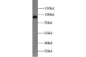 Western blot analysis of HeLa cells subjected to SDS-PAGE, using SUN1 antibody. (SUN1 anticorps  (AA 4-257))