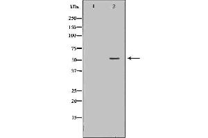 Western blot analysis of extracts of HL60, using FGR antibody. (Fgr anticorps  (Internal Region))