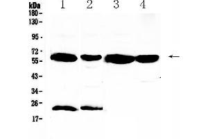 Western blot analysis of UGT1A1 using anti-UGT1A1 antibody .
