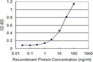 Detection limit for recombinant GST tagged ZNF263 is 0.