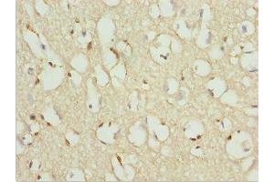 Immunohistochemistry of paraffin-embedded human brain tissue using ABIN7176144 at dilution of 1:100 (ZNF195 anticorps  (AA 1-250))