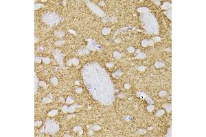 Immunohistochemistry of paraffin-embedded rat brain using Synaptophysin Rabbit pAb (ABIN6135349, ABIN6148783, ABIN6148784 and ABIN6221958) at dilution of 1:200 (40x lens).