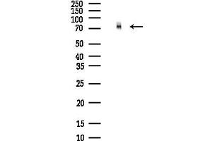 anti-Numb Homolog (NUMB) (C-Term) antibody