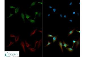Image no. 4 for anti-Teratocarcinoma-Derived Growth Factor 1 (TDGF1) (N-Term) antibody (ABIN363493)