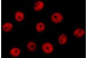 ABIN6267400 staining HepG2 by IF/ICC. (CREB1 anticorps  (pSer133))