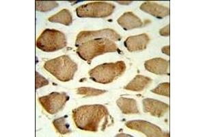Formalin-fixed and paraffin-embedded human skeletal muscle reacted with CAV2 Antibody (N-term), which was peroxidase-conjugated to the secondary antibody, followed by DAB staining.