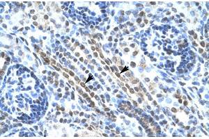 Human kidney (ANKRD11 anticorps  (N-Term))