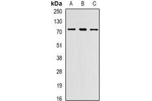 Western blot analysis of PRDM6 expression in Jurkat (A), MCF7 (B), mouse lung (C) whole cell lysates. (PRDM6 anticorps)