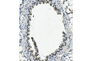 IHC analysis of NHEJ1 using anti-NHEJ1 antibody (ABIN7599198). (NHEJ1 anticorps  (AA 1-273))