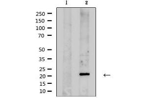 Western blot analysis of extracts from rat brain , using KCNMB1 Antibody. (KCNMB1 anticorps)