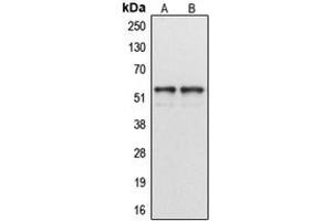 Western blot analysis of Cytochrome P450 1A1/2 expression in MCF7 (A), HeLa (B) whole cell lysates. (CYP1A1/2 anticorps  (Center))