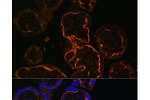 Immunofluorescence analysis of Human placenta cells using LDB3 Polyclonal Antibody at dilution of 1:100. (LIM Domain Binding 3 Protein anticorps)