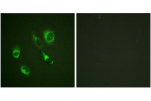 Immunofluorescence staining of methanol-fixed HeLa cells using EPHA2/3/4 (Phospho-Tyr588/596) Antibody. (EPH Receptor A2 anticorps  (pTyr588, pTyr596))