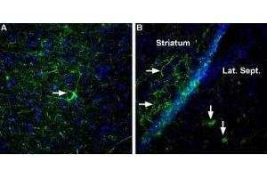 Expression of Neurexin 3α in rat and mouse brain - Immunohistochemical staining of rat entorhinal cortex (A) and mouse striatum and lateral septum (B) using Anti-Neurexin 3α (extracellular) Antibody (ABIN7043359, ABIN7044678 and ABIN7044679), (1:400).