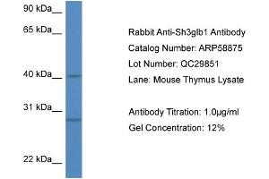 Western Blotting (WB) image for anti-SH3-Domain GRB2-Like Endophilin B1 (SH3GLB1) (N-Term) antibody (ABIN2787862) (SH3GLB1 anticorps  (N-Term))