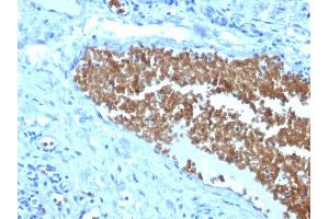 Formalin-fixed, paraffin-embedded human Tonsil stained with Spectrin alpha 1 (SPTA1) Mouse Monoclonal Antibody (SPTA1/1832).