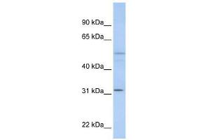 ZFYVE19 antibody used at 0. (ZFYVE19 anticorps  (C-Term))