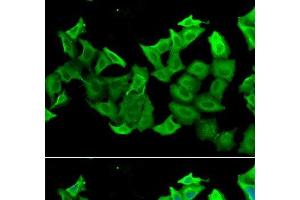 Immunofluorescence analysis of A549 cells using HAGH Polyclonal Antibody (HAGH anticorps)