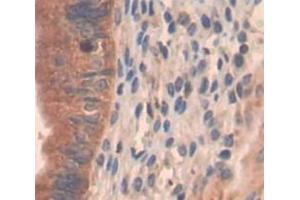 Used in DAB staining on fromalin fixed paraffin- embedded Kidney tissue (PI4KA anticorps  (AA 1-300))