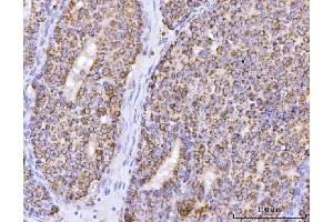 IHC analysis of ATP5F1B using anti-ATP5F1B antibody (ABIN7599866). (Atp5f1b (AA 123-529) anticorps)