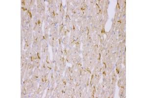 IHC analysis of Desmin using anti-Desmin antibody (ABIN3043265).