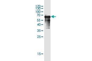 Western Blot detection against Immunogen (65. (SERTAD4 anticorps  (AA 1-356))