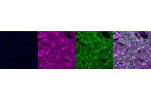 Immunohistochemistry (IHC) image for anti-Protein Phosphatase 1, Regulatory (Inhibitor) Subunit 1B (PPP1R1B) antibody (ABIN7456071)